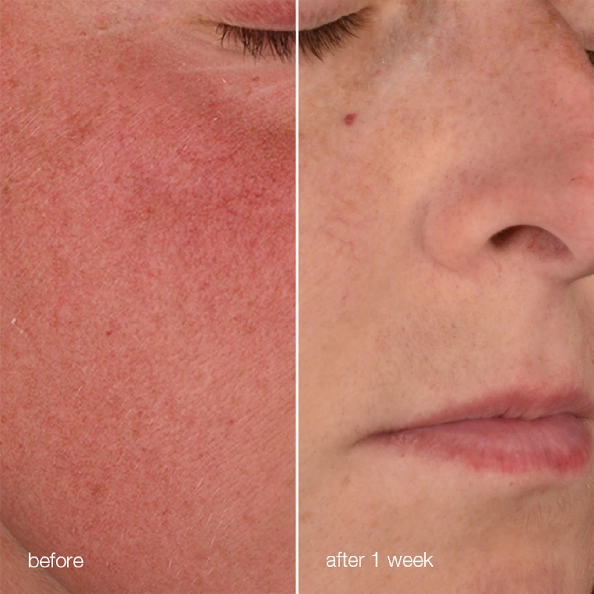 Dermalogica Stabilizing Repair Cream