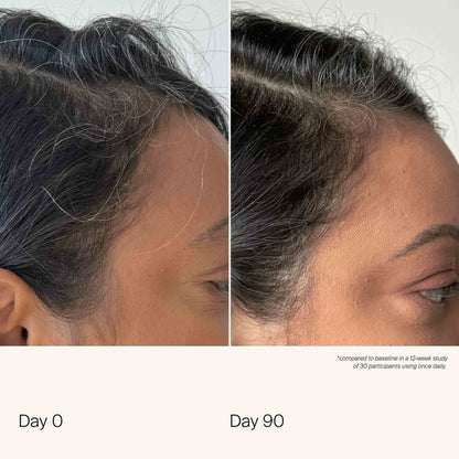 Living Proof Scalp Care Density Serum