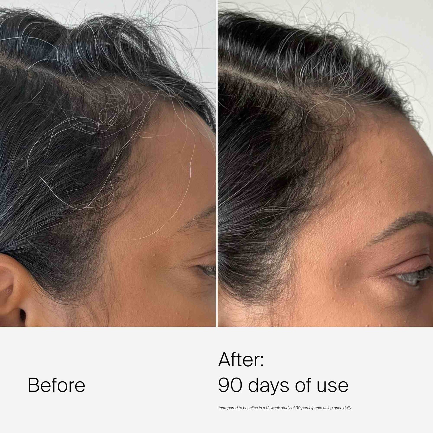 Living Proof Scalp Care Exfoliator