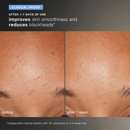 Dermalogica Daily Microfoliant - 13G