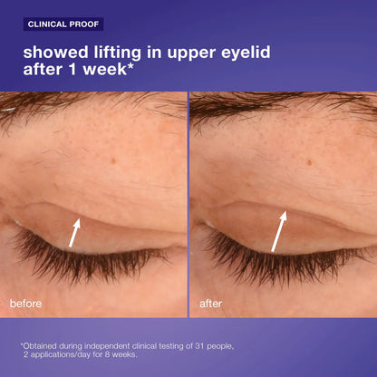 Dermalogica Phyto Nature Lifting Eye Cream