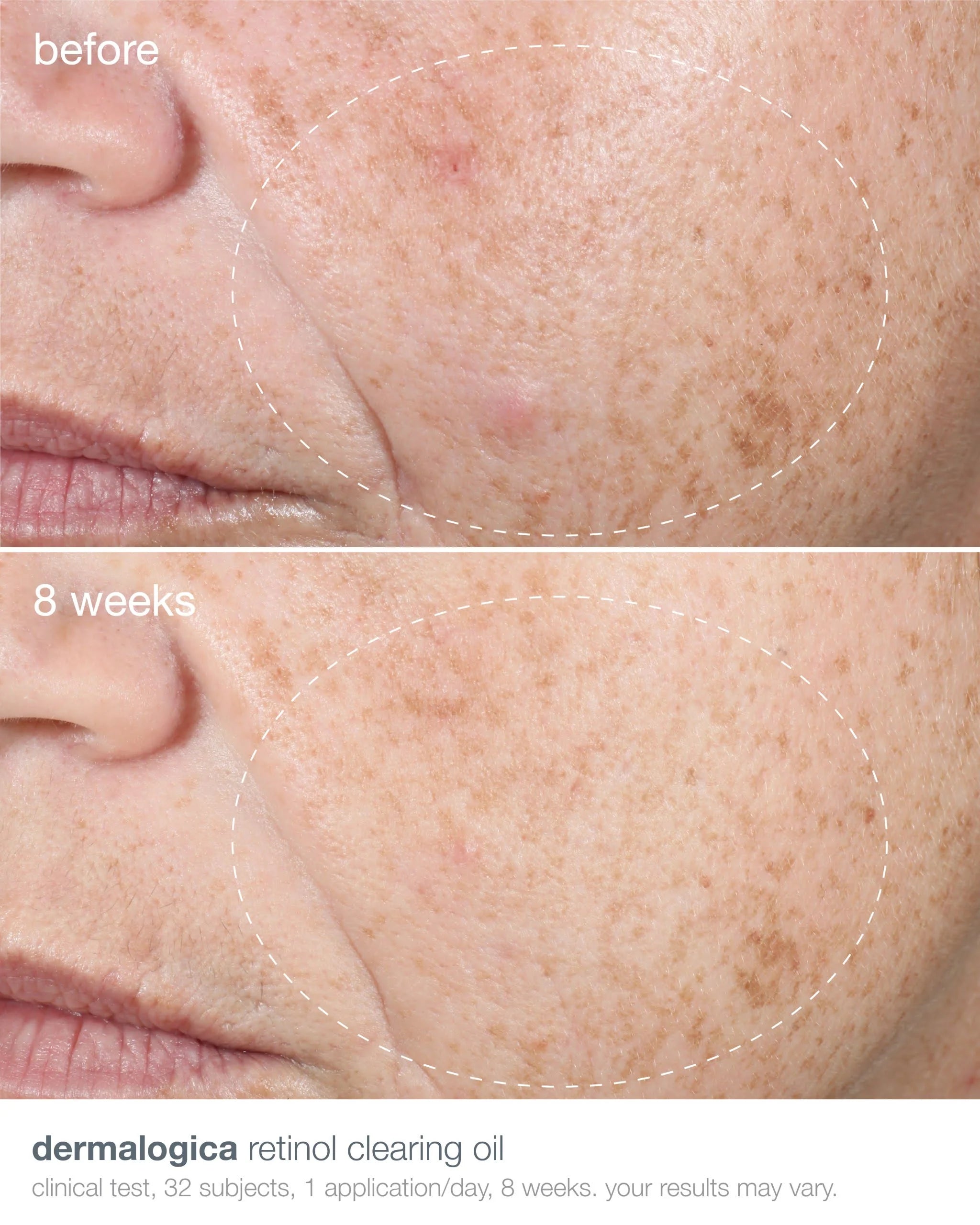 Dermalogica Retinol Clearing Oil